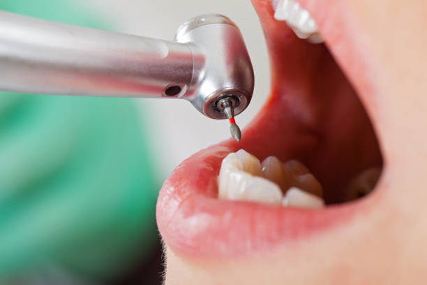 Best Mobile Emergency Dentist in Hahira, GA